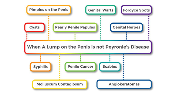 a graph showing different conditions when a lump is not Peyronie's Disease