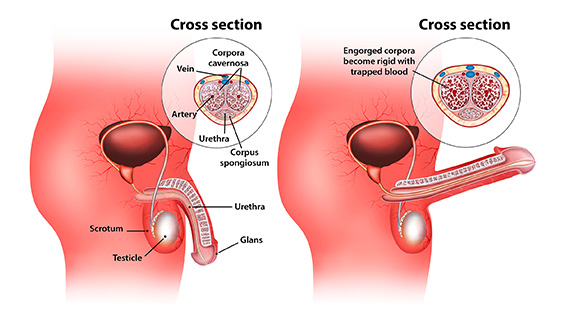 an illustration showing the contrast between a flaccid penis and erect penis