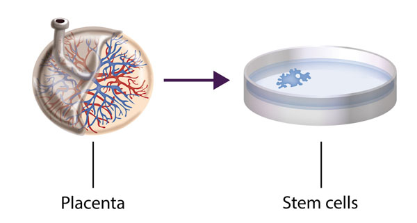 a diagram highlighting how stem cell therapy works for Peyronie's Disease treatment