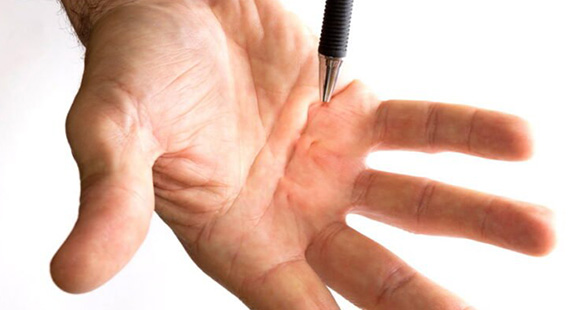 a persons outstretched hand with a pen pressing into their hand