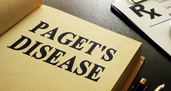a book with Paget's Disease printed on the front in large print