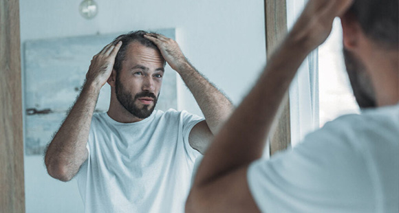 a man suffering from pattern baldness looking at his hairline in a mirror