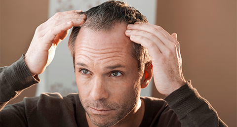 a man observing his receding hair line